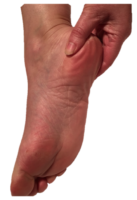 Heel pain / plantar fasciiitis